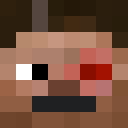Skin head 25cd5f3334e00b0cd39626b0f5467a31
